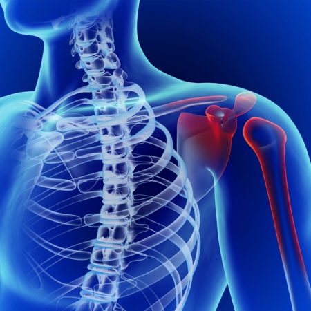 Rotator Cuff Injuries